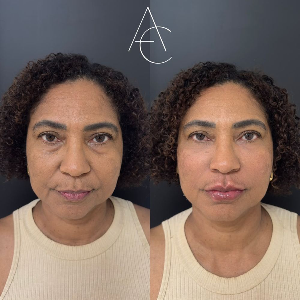 Registro de resultado de procedimento realizado por Andréa Chaves