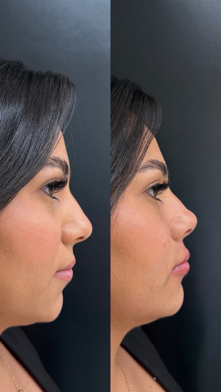 Registro de resultado de procedimento realizado por Andréa Chaves