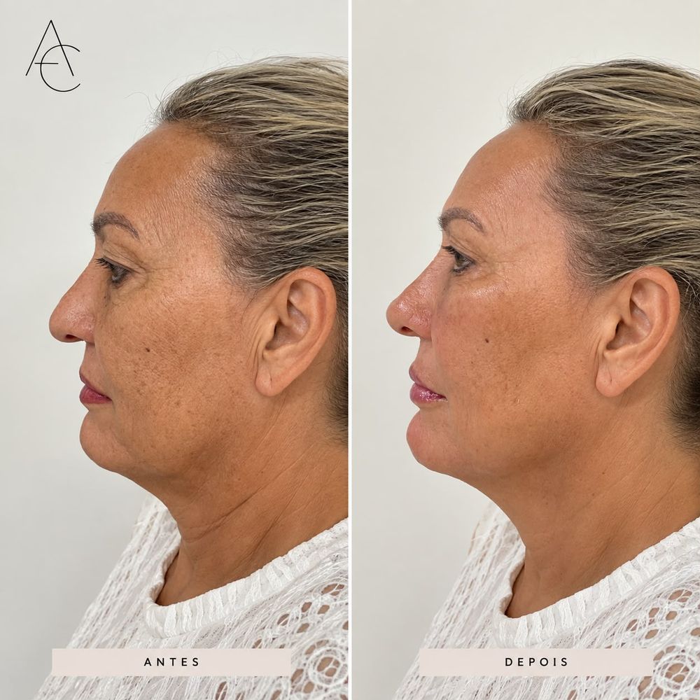 Registro de resultado de procedimento realizado por Andréa Chaves
