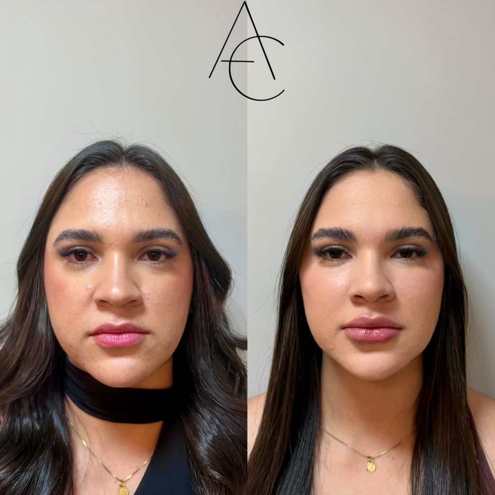 Registro de resultado de procedimento realizado por Andréa Chaves