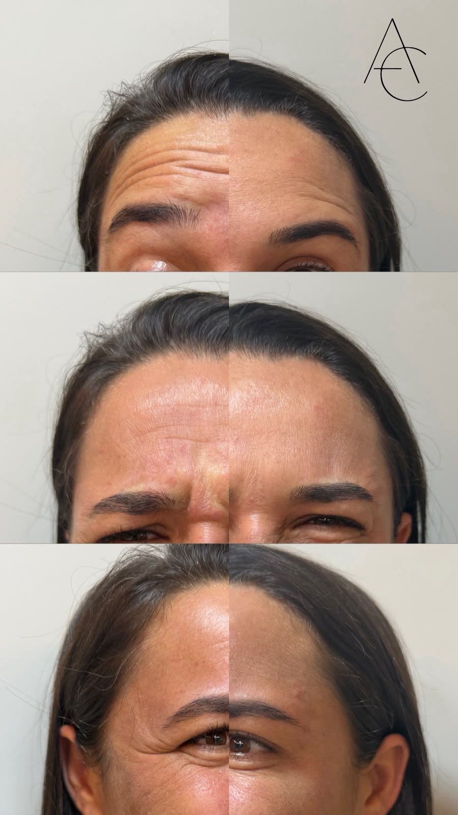 Registro de resultado de procedimento realizado por Andréa Chaves