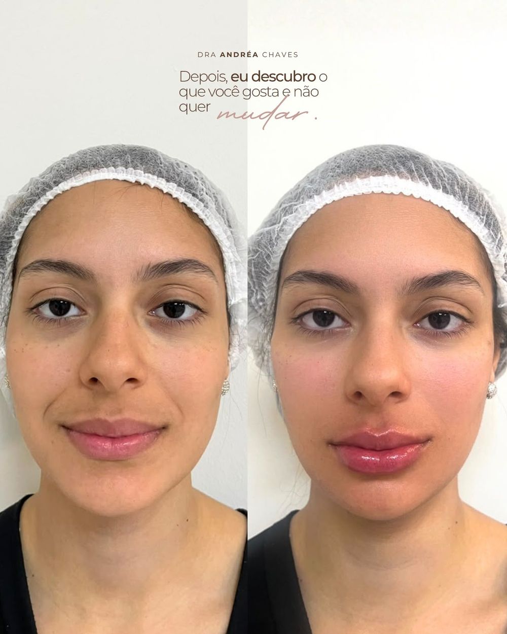 Registro de resultado de procedimento realizado por Andréa Chaves