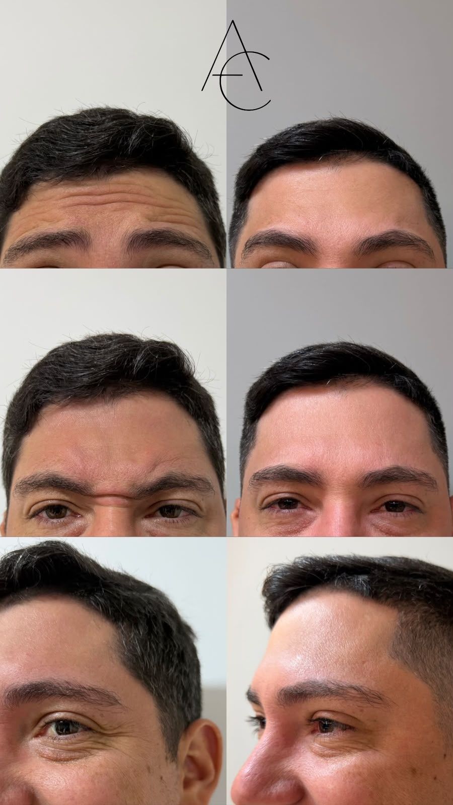 Registro de resultado de procedimento realizado por Andréa Chaves